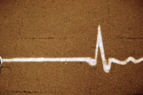 Linie eines Herzschlages / EKG