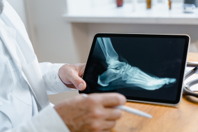 Arzt betrachtet Röntgenbild auf Tablet