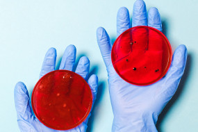 Wissenschaftler hält Petrischalen