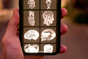 Smartphone mit anatomischen Illustrationen