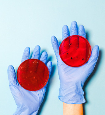 Wissenschaftler hält Petrischalen