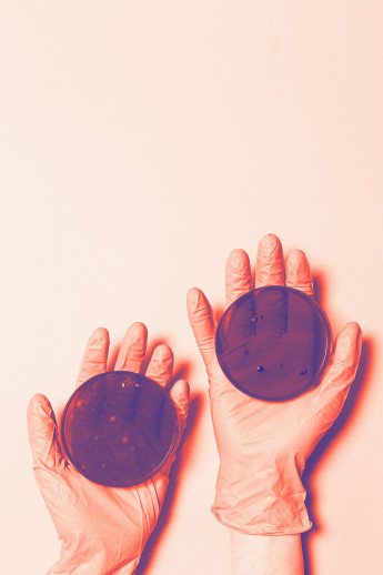 Zwei Petri-Schalen in Händen mit rosa Gummihandschuhen, eine mit gelartiger Substanz, die andere mit abweichender Textur.