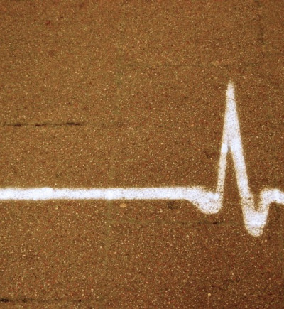 Linie eines Herzschlages / EKG